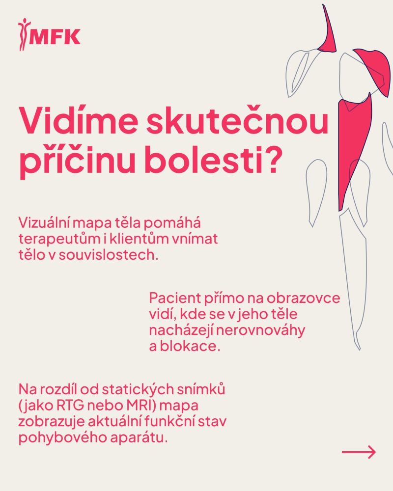 Slide s otázkou „Vidíme skutečnou příčinu bolesti?“ a mapou těla se zvýrazněnými oblastmi