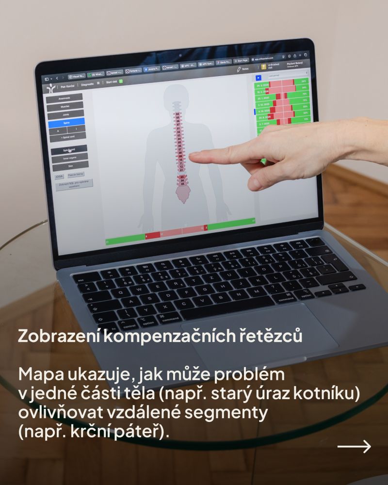 Snímek 2 karuselu LinkedIn příspěvku: Každý den při vyšetření získáváme velké množství informací a hledáme mezi nimi souvislosti.